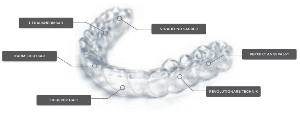 Die transparente Zahnspange (Smile Alignern) zum herausnehmen - Smile Clinic Salzburg